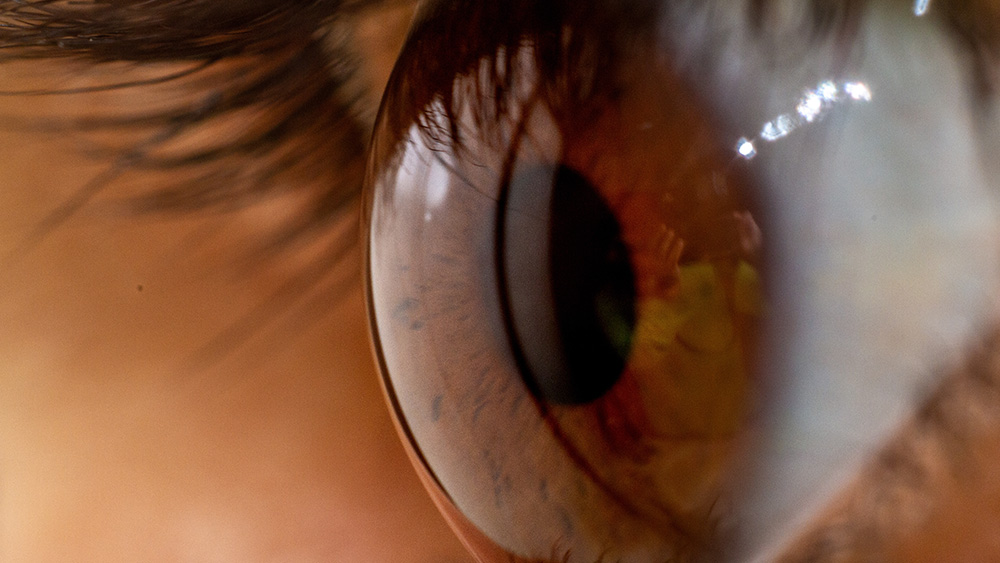 Types of Corrective Eye Surgery and How to Choose the Right One